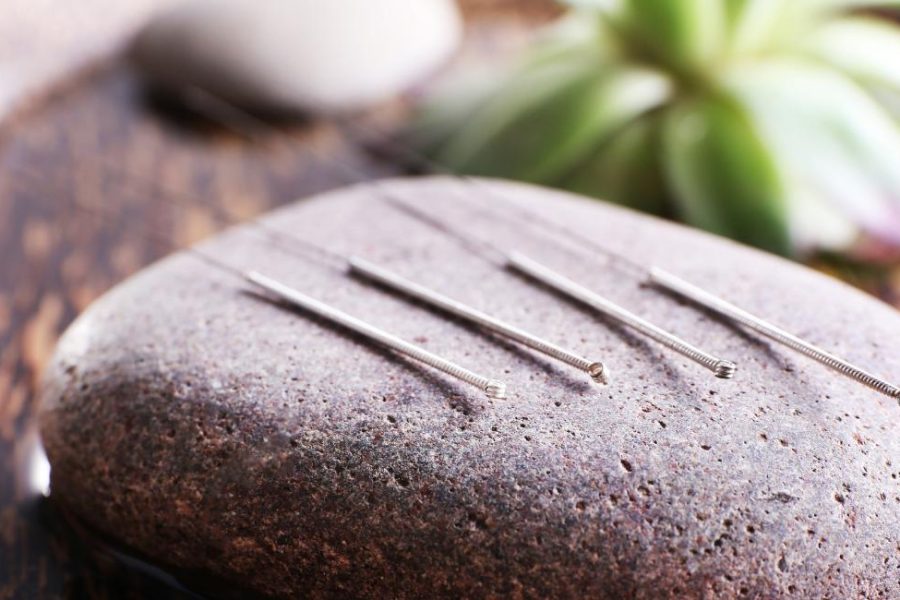 acupuncture for stress