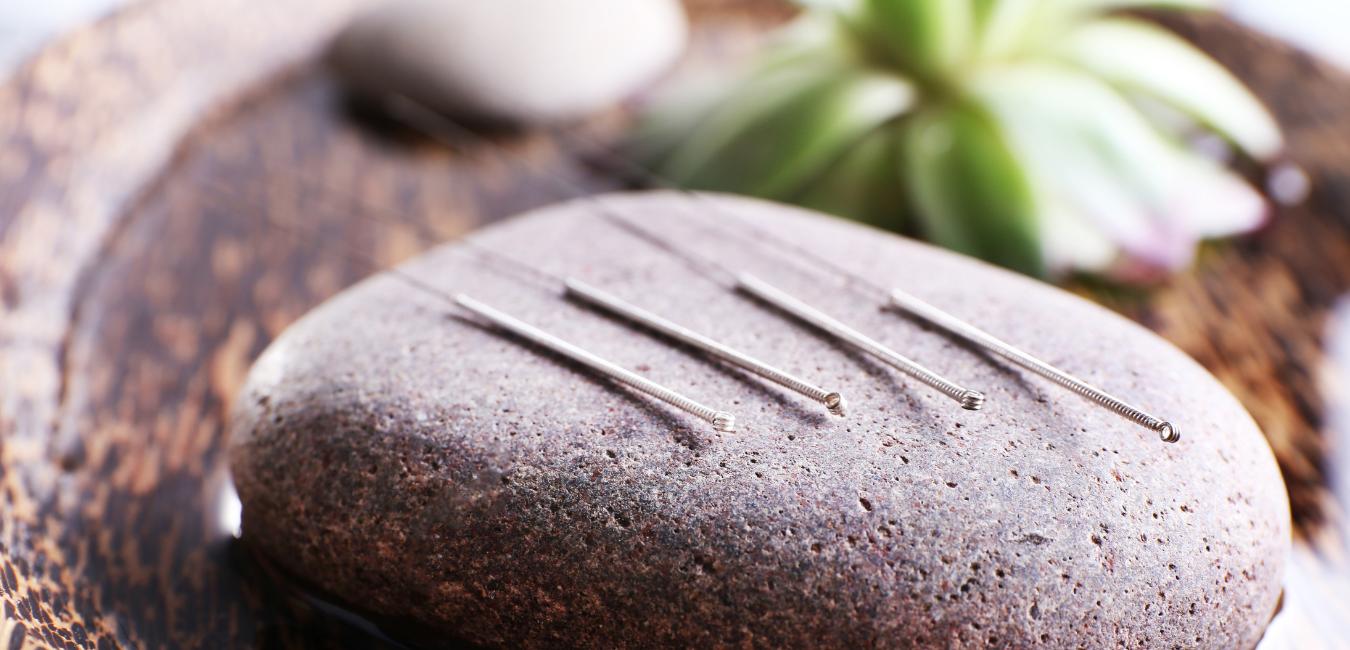 acupuncture for stress