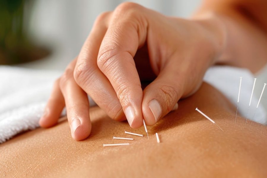acupuncture during two week wait