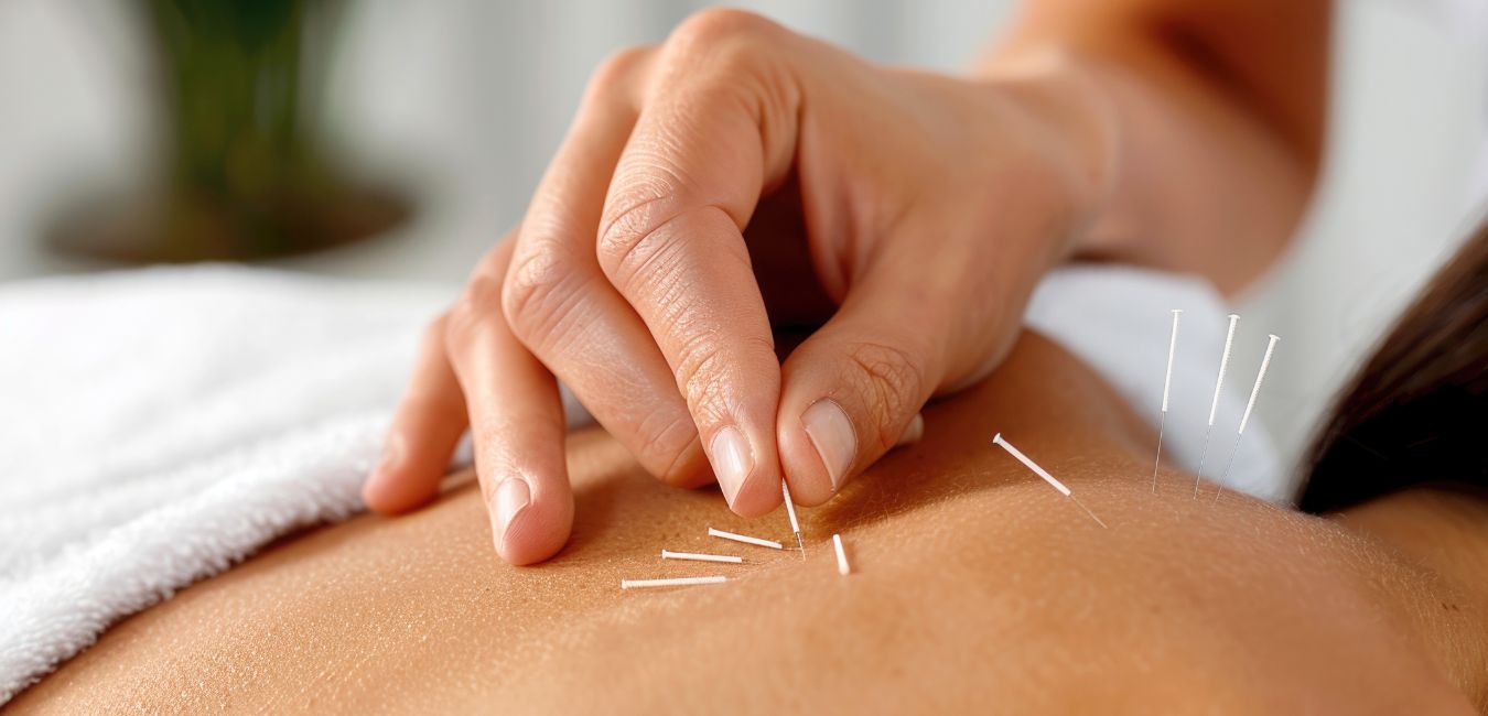acupuncture during two week wait